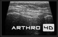 Ultrahang diagnosztika